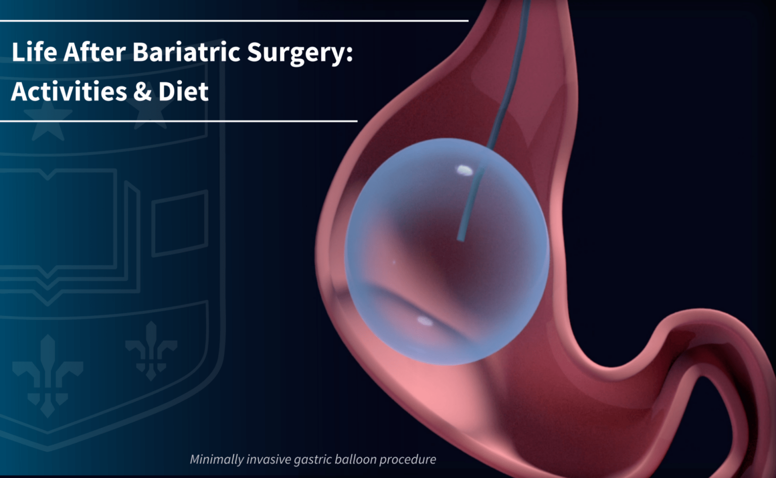Life After Bariatric Surgery: Activities & Diet - Weight Loss Surgery