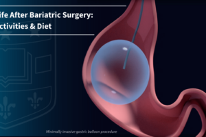 Life After Bariatric Surgery: Activities & Diet